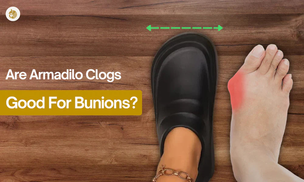 Are Cloggies Good for Bunions?